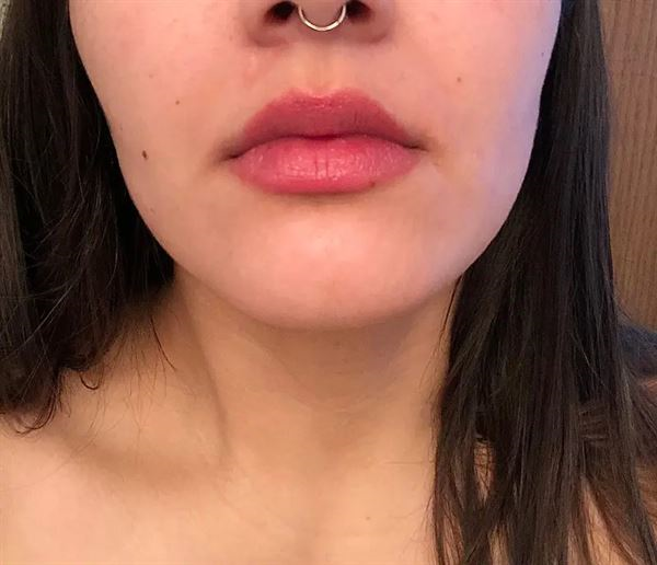 Lumi™ IPL Laser Hair Removal Handset photo review