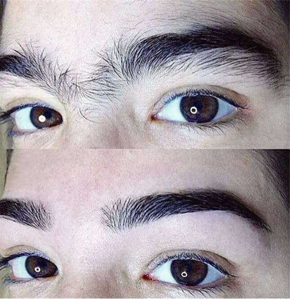 Lumi™ IPL Laser Hair Removal Handset photo review