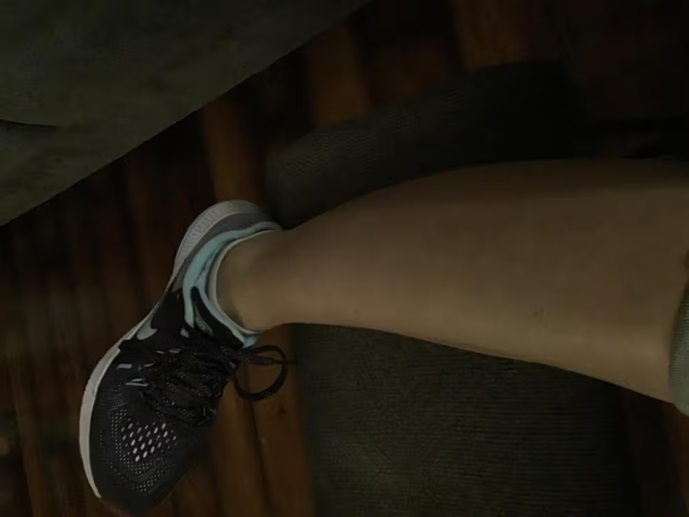 Lumi™ IPL Laser Hair Removal Handset photo review