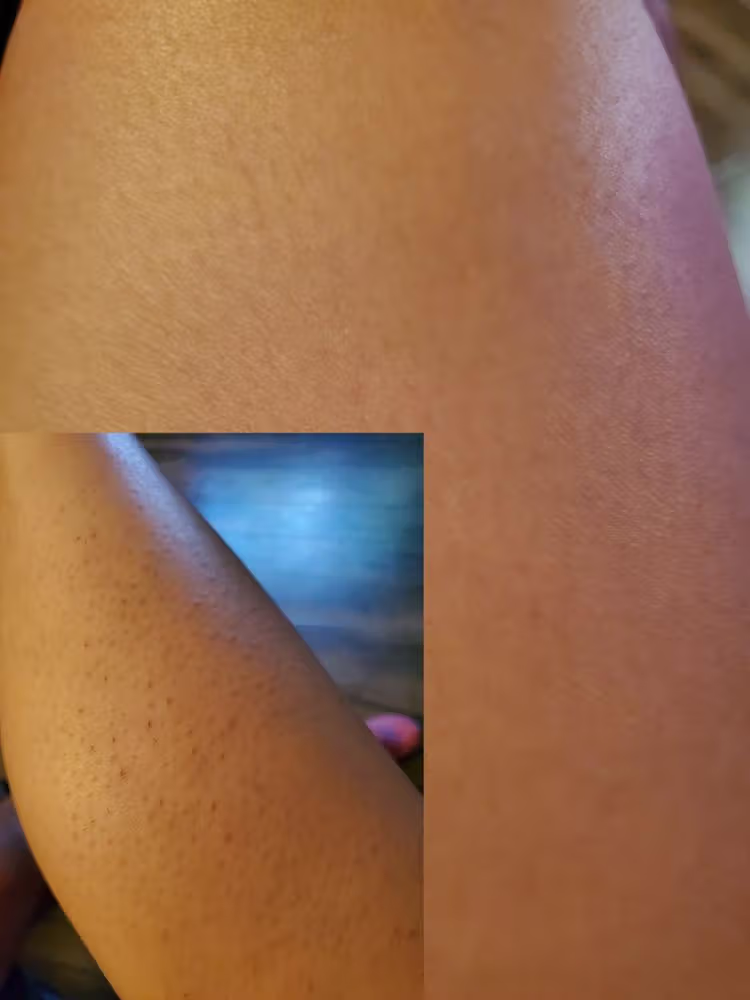 Lumi™ IPL Laser Hair Removal Handset photo review