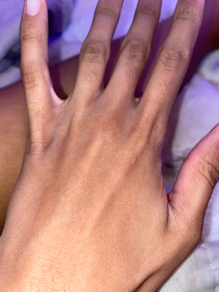 Lumi™ IPL Laser Hair Removal Handset photo review