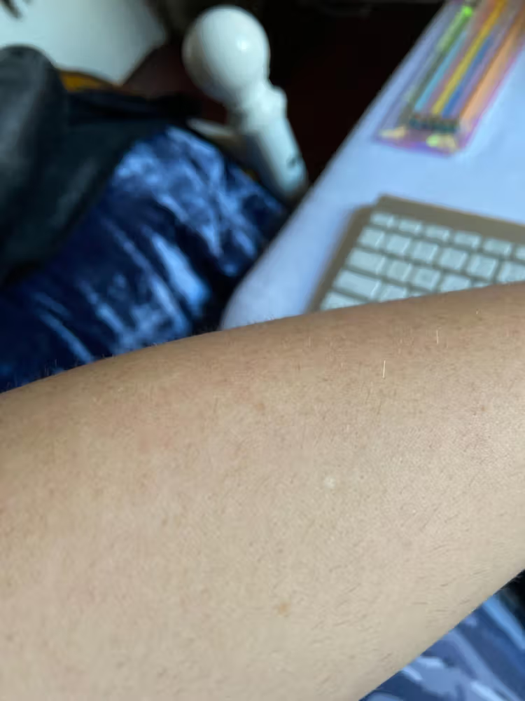 Lumi™ IPL Laser Hair Removal Handset photo review