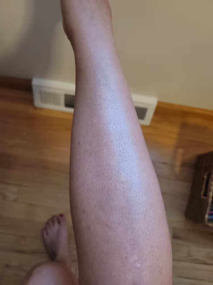 Lumi™ IPL Laser Hair Removal Handset photo review