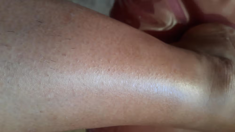Lumi™ IPL Laser Hair Removal Handset photo review