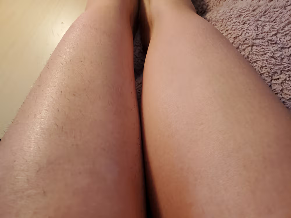 Lumi™ IPL Laser Hair Removal Handset photo review