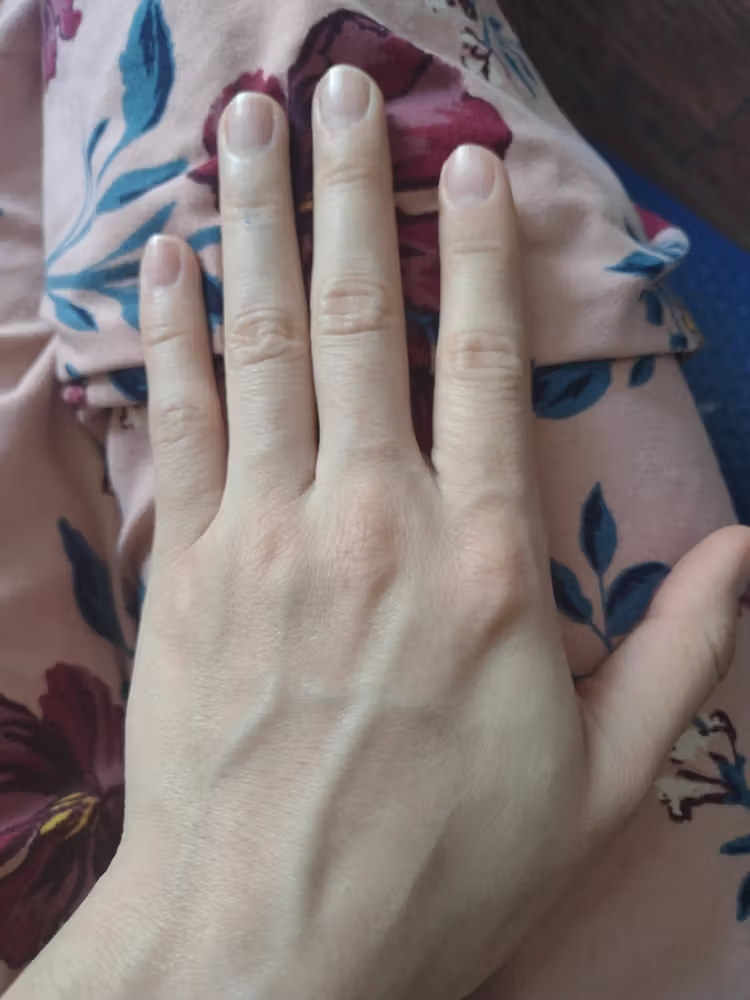 Lumi™ IPL Laser Hair Removal Handset photo review