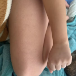 Lumi™ IPL Laser Hair Removal Handset