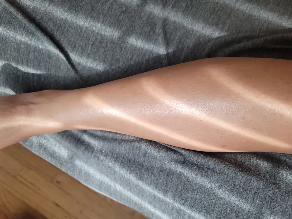 Lumi™ IPL Laser Hair Removal Handset photo review