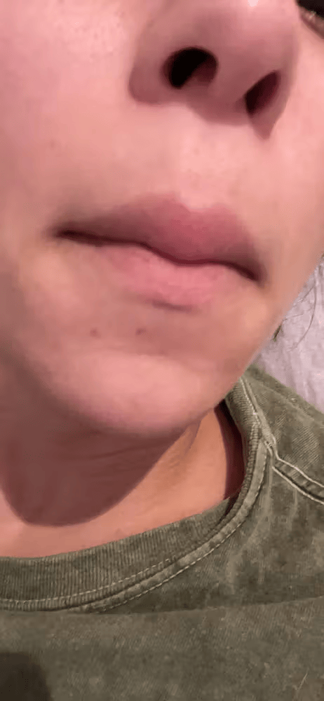 Lumi™ IPL Laser Hair Removal Handset photo review