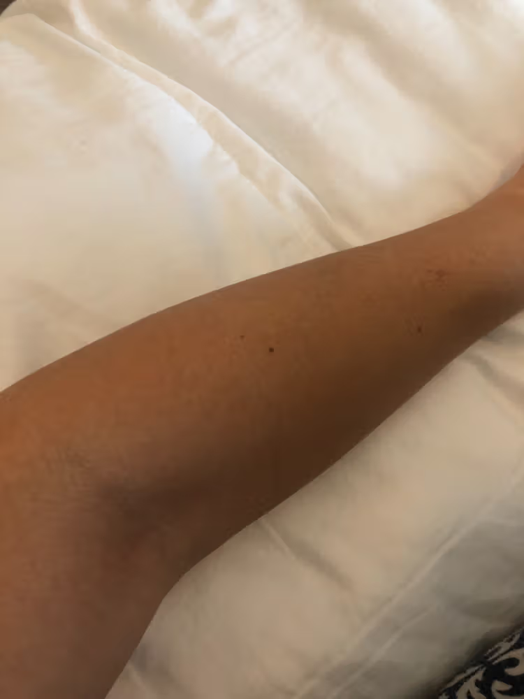 Lumi™ IPL Laser Hair Removal Handset photo review