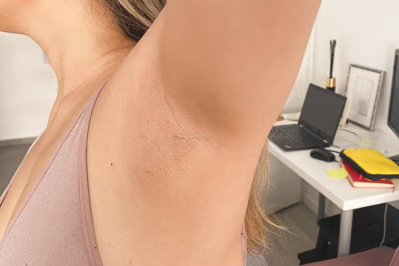 Lumi™ IPL Laser Hair Removal Handset photo review