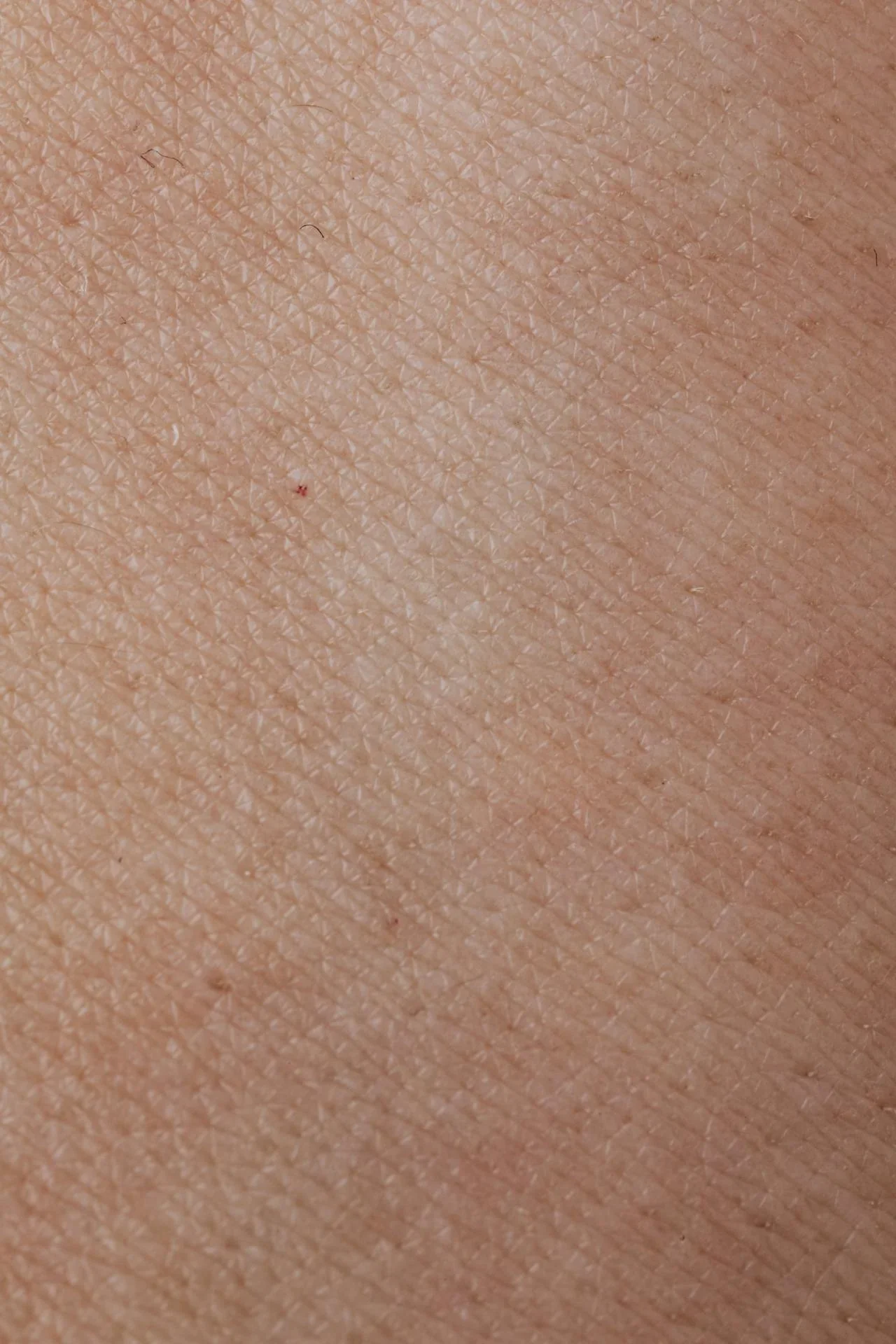 After image